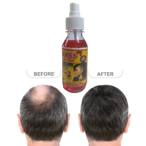 African Class Herbal Hair Growth